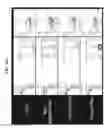 Fig. 20 - Methods and compositions for preventing or treating ophthalmic conditions