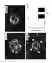 Fig. 29 - Methods and compositions for preventing or treating ophthalmic conditions
