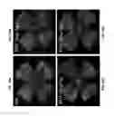 Fig. 31 - Methods and compositions for preventing or treating ophthalmic conditions