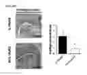 Fig. 06 - Method for treating arthritis using IK factor or nucleic acid encoding IK factor