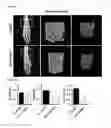Fig. 07 - Method for treating arthritis using IK factor or nucleic acid encoding IK factor