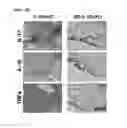 Fig. 08 - Method for treating arthritis using IK factor or nucleic acid encoding IK factor