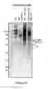 Fig. 04 - FACTOR VIII POLYMER CONJUGATES