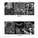 Fig. 03 - Therapeutic for treating clostridium difficile infection