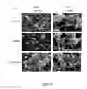 Fig. 04 - Therapeutic for treating clostridium difficile infection