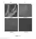 Fig. 10 - Therapeutic for treating clostridium difficile infection