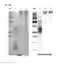 Fig. 20 - Immunogenic complex for vaccination and method for the production thereof
