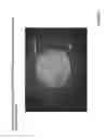 Fig. 28 - Crosslinked chitosan-lactide hydrogels