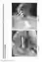 Fig. 30 - Crosslinked chitosan-lactide hydrogels