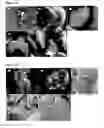 Fig. 26 - Solid dosage form containing arabinogalactan