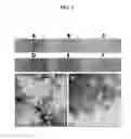 Fig. 02 - Nanodiamond particle complexes