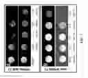 Fig. 08 - Preparation of bone-seeking superparamagnetic iron nanoparticles as contrast agents and methods for using the same