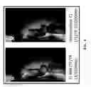 Fig. 09 - Preparation of bone-seeking superparamagnetic iron nanoparticles as contrast agents and methods for using the same