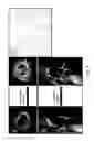 Fig. 10 - Preparation of bone-seeking superparamagnetic iron nanoparticles as contrast agents and methods for using the same