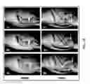 Fig. 11 - Preparation of bone-seeking superparamagnetic iron nanoparticles as contrast agents and methods for using the same