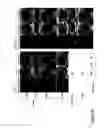 Fig. 10 - MICROPARTICLE COMPOSITIONS