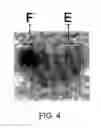 Fig. 05 - DIAGNOSIS OF PROSTATE CANCER