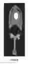 Fig. 28 - Radioactive bone cement