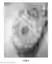 Fig. 31 - Radioactive bone cement