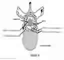Fig. 34 - Radioactive bone cement