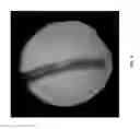 Fig. 05 - MULTI-STEP METHOD FOR FABRICATING TISSUE ENGINEERING BONE