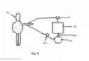 Fig. 04 - BLOOD CLEANSING AND APPARATUS & METHOD