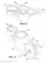 Fig. 13 - Drug delivery device