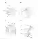 Fig. 03 - PEN-TYPE DRUG INJECTION DEVICE AND DOSE SETTING LIMITER MECHANISM THEREFOR