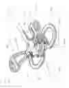 Fig. 33 - Huber safety needle