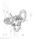 Fig. 46 - Huber safety needle