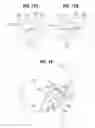 Fig. 09 - Nasal aerosol delivery system