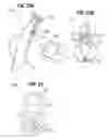 Fig. 12 - Nasal aerosol delivery system
