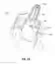 Fig. 19 - Nasal aerosol delivery system