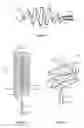 Fig. 04 - Treatment fluid delivery method, and turbulator for promoting uptake of a treatment agent
