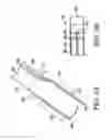 Fig. 07 - Steerable sheath including elastomeric member