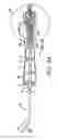 Fig. 14 - MRI compatible control handle for steerable sheath with audible, tactile and/or visual means