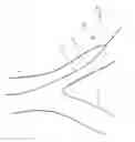 Fig. 04 - Method and apparatus for guiding a catheter