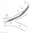 Fig. 05 - Method and apparatus for guiding a catheter