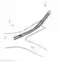 Fig. 06 - Method and apparatus for guiding a catheter