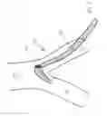Fig. 07 - Method and apparatus for guiding a catheter