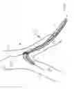 Fig. 09 - Method and apparatus for guiding a catheter