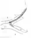 Fig. 10 - Method and apparatus for guiding a catheter