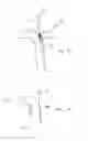 Fig. 15 - Method and apparatus for guiding a catheter