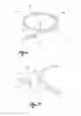 Fig. 02 - Guide-wire kit and assembly, use and mounting methods