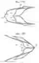Fig. 14 - Devices and methods for control of blood pressure