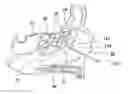 Fig. 01 - Balloon catheters and methods for treating paranasal sinuses