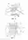 Fig. 04 - Balloon catheters and methods for treating paranasal sinuses