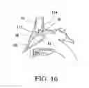 Fig. 10 - Balloon catheters and methods for treating paranasal sinuses