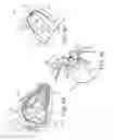 Fig. 08 - Interventional medical systems, devices, and components thereof