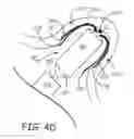 Fig. 09 - Interventional medical systems, devices, and components thereof
